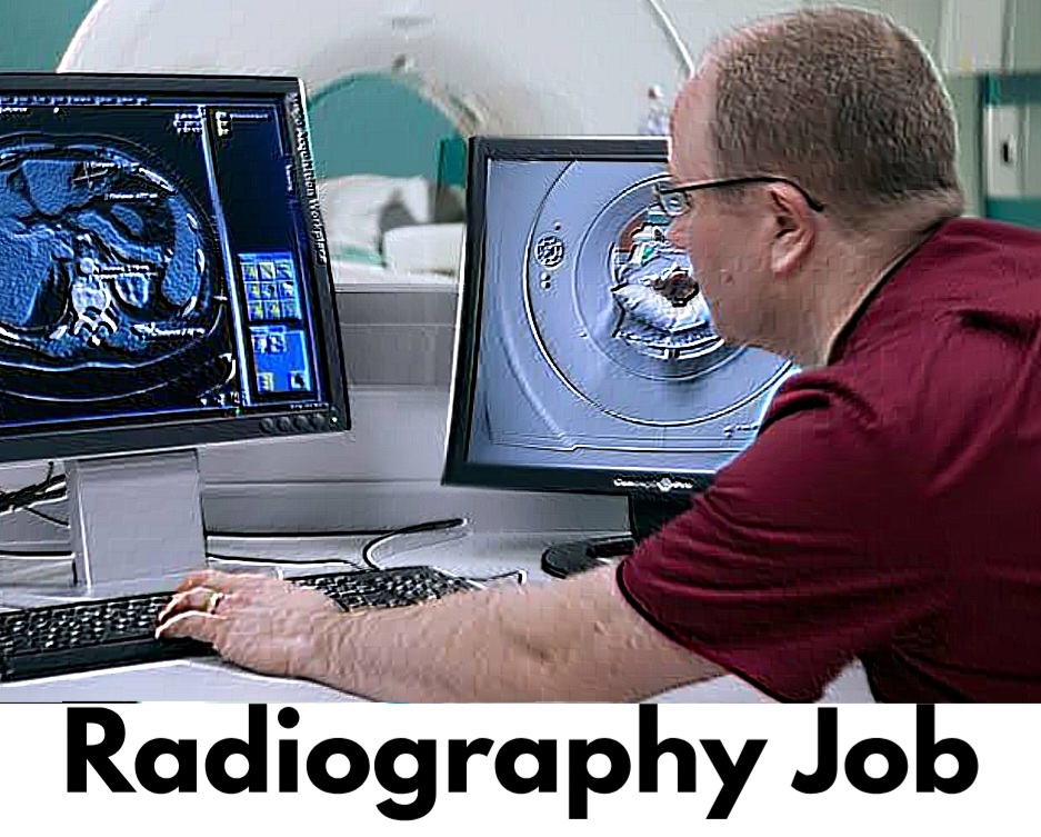 Radiography Jobs in the UK